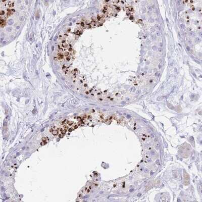 Immunohistochemistry-Paraffin: LRRC37A2 Antibody [NBP2-33438]