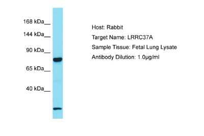 Western Blot: LRRC37A2 Antibody [NBP2-85228]