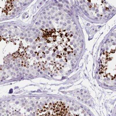 Immunohistochemistry-Paraffin: LRRC37A Antibody [NBP2-46690]