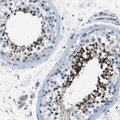 Immunohistochemistry-Paraffin: LRRC37B Antibody [NBP1-91094]