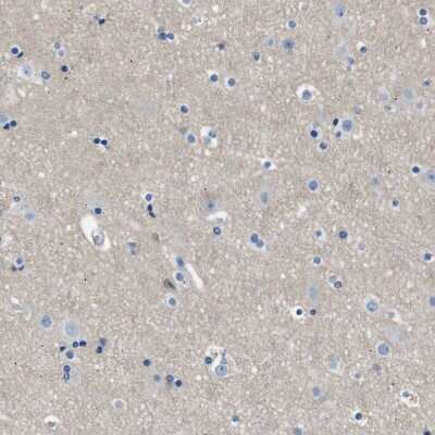 Immunohistochemistry-Paraffin: LRRC37B Antibody [NBP1-91094]