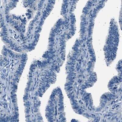 Immunohistochemistry-Paraffin: LRRC37B Antibody [NBP1-91094]
