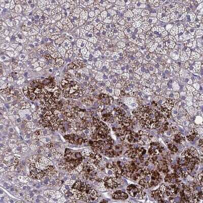 Immunohistochemistry-Paraffin: LRRC38 Antibody [NBP1-90986]