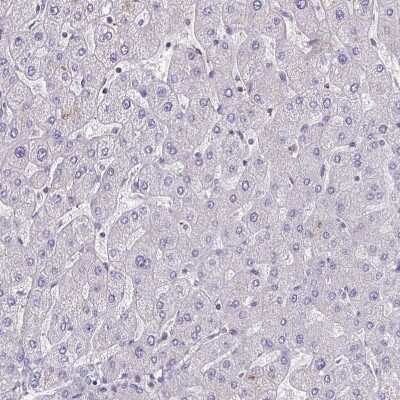 Immunohistochemistry-Paraffin: LRRC38 Antibody [NBP1-90986]