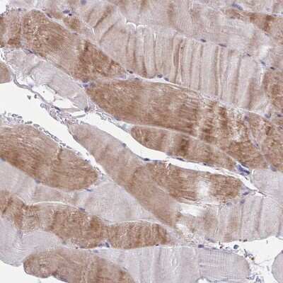Immunohistochemistry-Paraffin: LRRC38 Antibody [NBP1-90986]