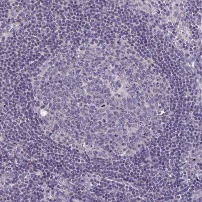 Immunohistochemistry-Paraffin: LRRC38 Antibody [NBP1-90986]