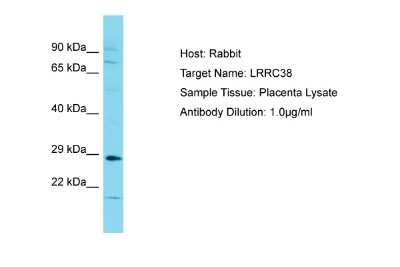 Western Blot: LRRC38 Antibody [NBP2-83155]