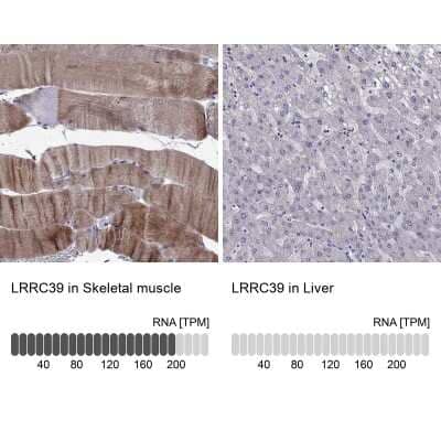 Immunohistochemistry-Paraffin: LRRC39 Antibody [NBP2-62714]