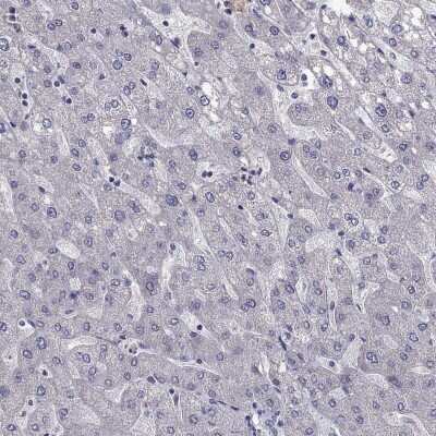 Immunohistochemistry-Paraffin: LRRC39 Antibody [NBP2-62714]