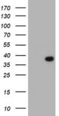 Western Blot: LRRC39 Antibody (OTI2D9)Azide and BSA Free [NBP2-72533]