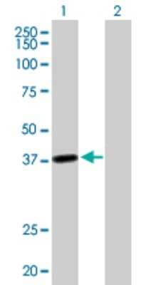 Western Blot: LRRC39 Antibody [H00127495-B01P]