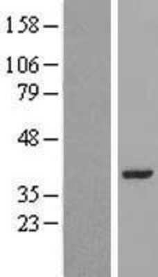 Western Blot: LRRC39 Overexpression Lysate [NBL1-12691]