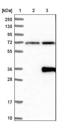 Western Blot: LRRC3B/LRP15 Antibody [NBP1-89579]