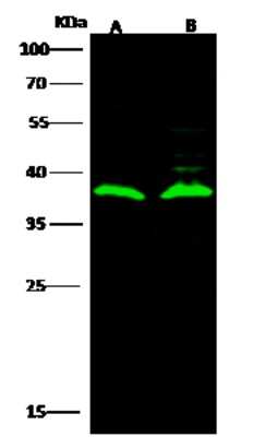 Western Blot: LRRC3B/LRP15 Antibody [NBP2-97006]