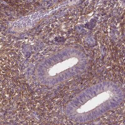 Immunohistochemistry: LRRC3C Antibody [NBP2-49651]