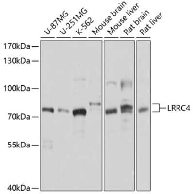 Western Blot: LRRC4 AntibodyBSA Free [NBP3-05099]