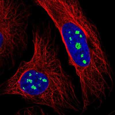 Immunocytochemistry/ Immunofluorescence: LRRC40 Antibody [NBP1-82185]