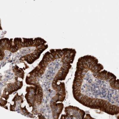 Immunohistochemistry-Paraffin: LRRC40 Antibody [NBP1-82185]