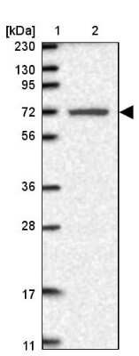 Western Blot: LRRC40 Antibody [NBP1-82185]