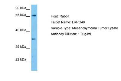 Western Blot: LRRC40 Antibody [NBP2-83157]