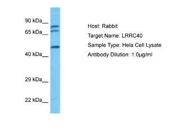 Western Blot: LRRC40 Antibody [NBP2-83158]