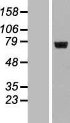 Western Blot: LRRC40 Overexpression Lysate [NBL1-12693]