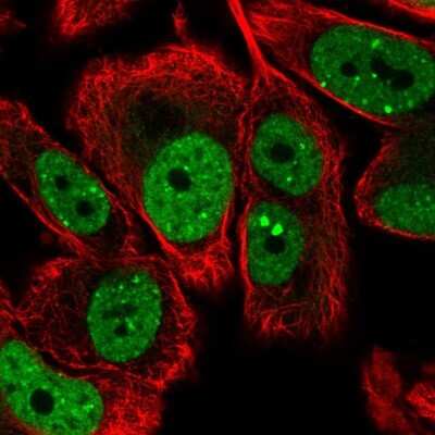 Immunocytochemistry/ Immunofluorescence: LRRC41 Antibody [NBP2-14200]