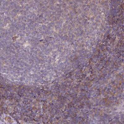 Immunohistochemistry-Paraffin: LRRC41 Antibody [NBP2-14200]