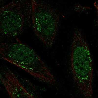 Immunocytochemistry/ Immunofluorescence: LRRC42 Antibody [NBP2-56987]