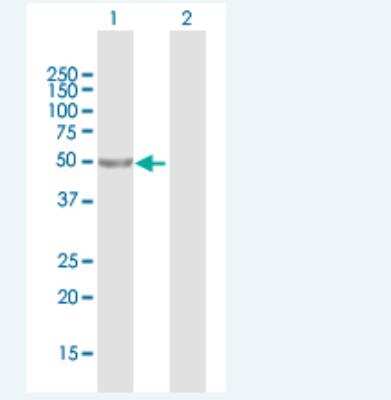 Western Blot: LRRC42 Antibody [H00115353-B01P-50ug]