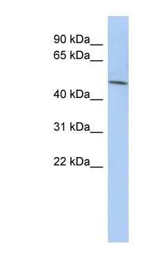 Western Blot: LRRC42 Antibody [NBP1-56701]