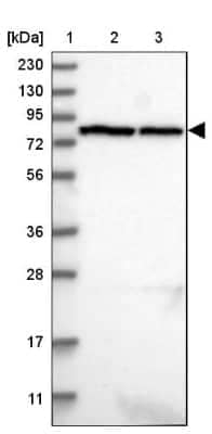 Western Blot: LRRC44 Antibody [NBP1-92078]