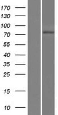 Western Blot: LRRC44 Overexpression Lysate [NBP2-11420]