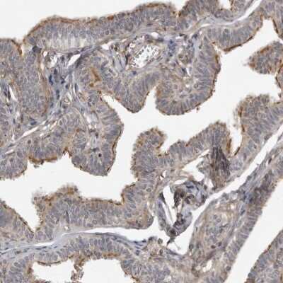 Immunohistochemistry-Paraffin: LRRC45 Antibody [NBP1-93509]