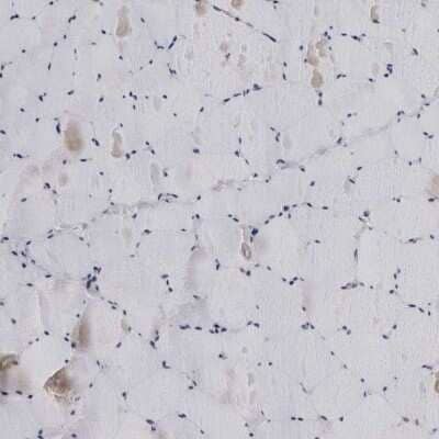 Immunohistochemistry-Paraffin: LRRC45 Antibody [NBP1-93509]