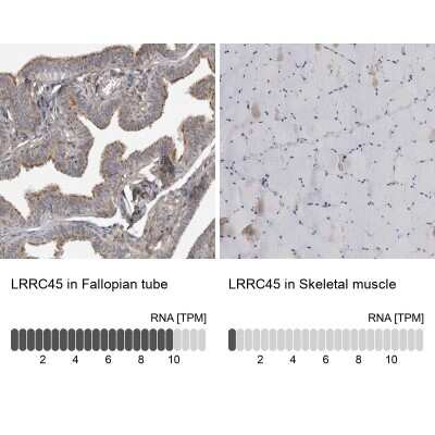 Immunohistochemistry-Paraffin: LRRC45 Antibody [NBP1-93509]