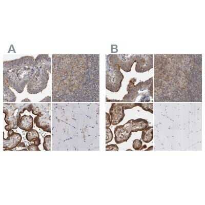 Immunohistochemistry-Paraffin: LRRC45 Antibody [NBP1-93509]