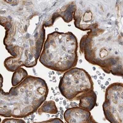 Immunohistochemistry-Paraffin: LRRC45 Antibody [NBP1-93509]
