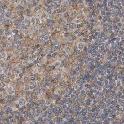 Immunohistochemistry-Paraffin: LRRC45 Antibody [NBP1-93509]