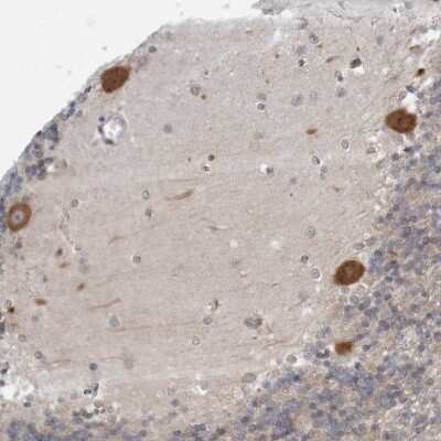 Immunohistochemistry-Paraffin: LRRC45 Antibody [NBP1-93510]
