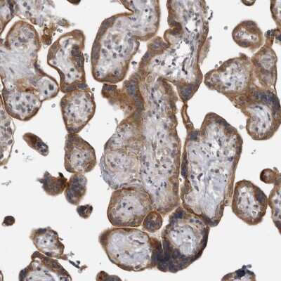 Immunohistochemistry-Paraffin: LRRC45 Antibody [NBP1-93510]