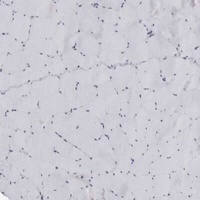 Immunohistochemistry-Paraffin: LRRC45 Antibody [NBP1-93510]