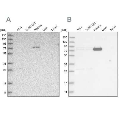 Western Blot: LRRC45 Antibody [NBP1-93509]