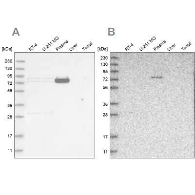 Western Blot: LRRC45 Antibody [NBP1-93510]