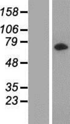 Western Blot: LRRC45 Overexpression Lysate [NBP2-05525]