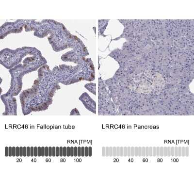 Immunohistochemistry-Paraffin: LRRC46 Antibody [NBP2-62692]