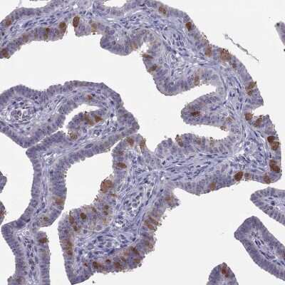 Immunohistochemistry-Paraffin: LRRC46 Antibody [NBP2-62692]