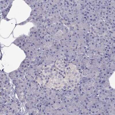 Immunohistochemistry-Paraffin: LRRC46 Antibody [NBP2-62692]
