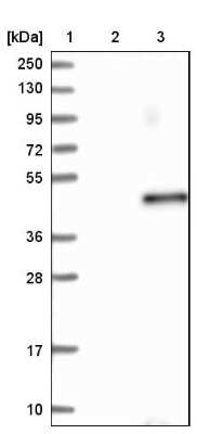 Western Blot: LRRC46 Antibody [NBP1-81189]