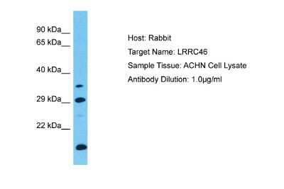 Western Blot: LRRC46 Antibody [NBP2-85229]